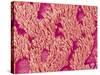 Trachea of a Rat-Micro Discovery-Stretched Canvas