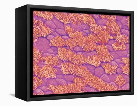 Trachea of a Rat-Micro Discovery-Framed Stretched Canvas