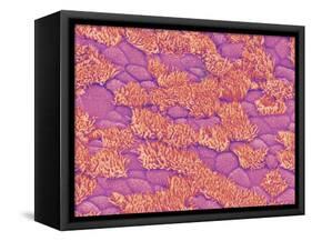 Trachea of a Rat-Micro Discovery-Framed Stretched Canvas