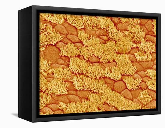 Trachea of a Rat-Micro Discovery-Framed Stretched Canvas