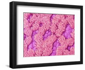 Trachea of a Rat-Micro Discovery-Framed Photographic Print