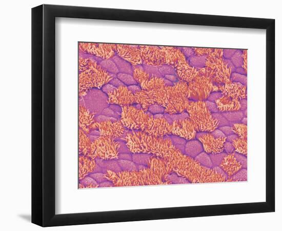 Trachea of a Rat-Micro Discovery-Framed Photographic Print