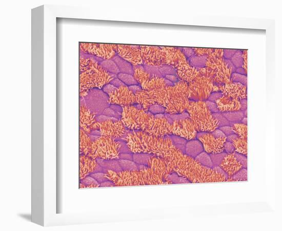 Trachea of a Rat-Micro Discovery-Framed Photographic Print