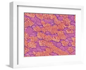 Trachea of a Rat-Micro Discovery-Framed Photographic Print