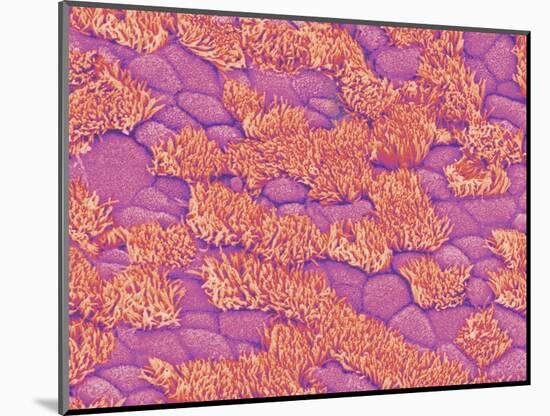 Trachea of a Rat-Micro Discovery-Mounted Photographic Print