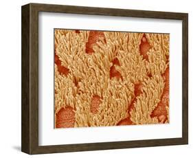 Trachea of a Rat-Micro Discovery-Framed Photographic Print