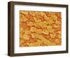 Trachea of a Rat-Micro Discovery-Framed Photographic Print