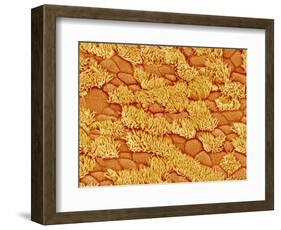 Trachea of a Rat-Micro Discovery-Framed Photographic Print