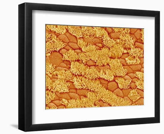 Trachea of a Rat-Micro Discovery-Framed Photographic Print