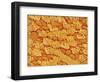 Trachea of a Rat-Micro Discovery-Framed Photographic Print