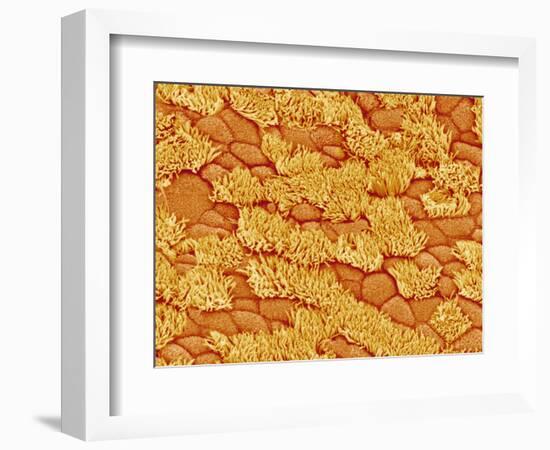 Trachea of a Rat-Micro Discovery-Framed Photographic Print