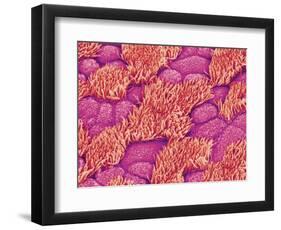 Trachea of a Rat-Micro Discovery-Framed Photographic Print