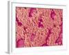 Trachea of a Rat-Micro Discovery-Framed Photographic Print