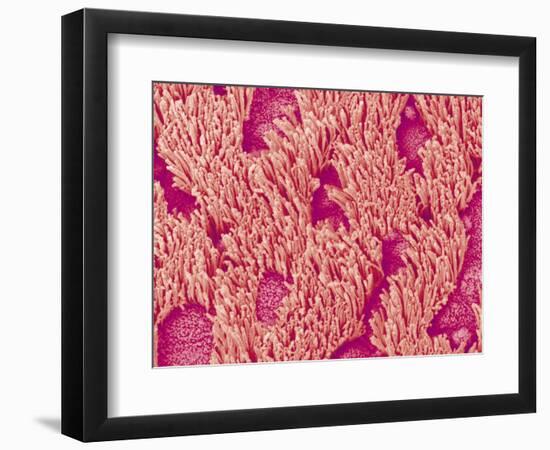 Trachea of a Rat-Micro Discovery-Framed Photographic Print