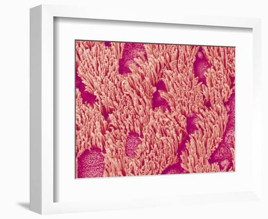 Trachea of a Rat-Micro Discovery-Framed Photographic Print