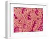 Trachea of a Rat-Micro Discovery-Framed Photographic Print