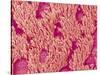 Trachea of a Rat-Micro Discovery-Stretched Canvas
