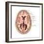 Transverse Section of the Brain-Evan Oto-Framed Art Print