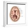 Transverse Section of the Brain-Evan Oto-Framed Art Print