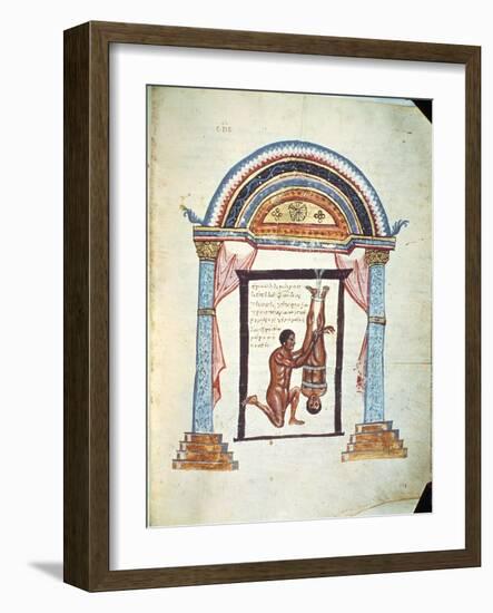 Treatment of a Dislocation, from a Commentary on the Hippocratic Treatise "On Joints"-null-Framed Giclee Print