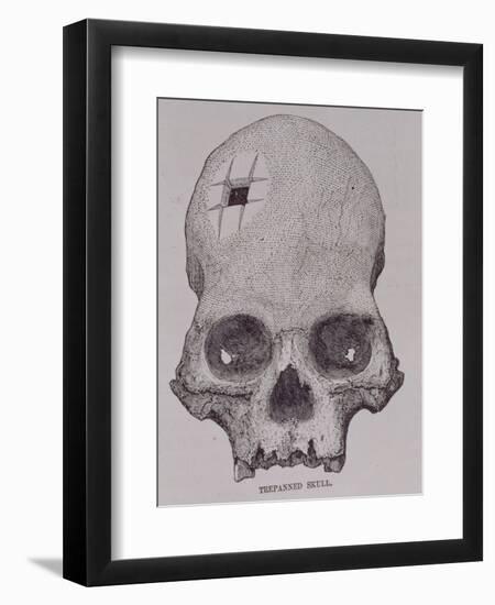 Trepanned Skull, from Incidents of Travel and Exploration in the Land of the Incas-null-Framed Giclee Print