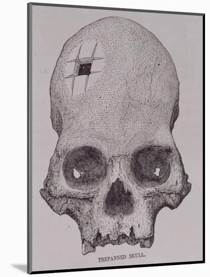 Trepanned Skull, from Incidents of Travel and Exploration in the Land of the Incas-null-Mounted Giclee Print