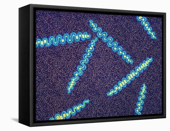 Treponema Pallidum Bacteria-null-Framed Stretched Canvas