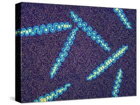 Treponema Pallidum Bacteria-null-Stretched Canvas