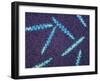 Treponema Pallidum Bacteria-null-Framed Premium Photographic Print