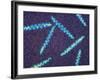 Treponema Pallidum Bacteria-null-Framed Photographic Print
