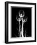 Trio Tulip Xray-Albert Koetsier-Framed Premium Giclee Print