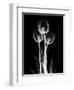 Trio Tulip Xray-Albert Koetsier-Framed Premium Giclee Print