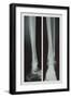 Two Ankles-null-Framed Art Print