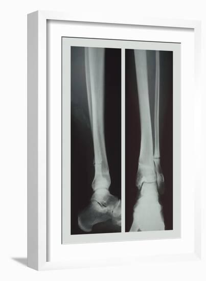 Two Ankles-null-Framed Art Print