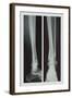 Two Ankles-null-Framed Art Print