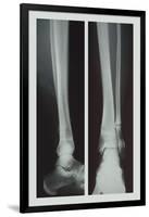 Two Ankles-null-Framed Art Print