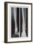 Two Ankles-null-Framed Art Print