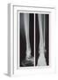 Two Ankles-null-Framed Art Print