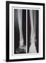 Two Ankles-null-Framed Art Print