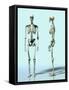 Two Skeletons-Matthias Kulka-Framed Stretched Canvas
