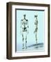 Two Skeletons-Matthias Kulka-Framed Premium Giclee Print