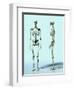 Two Skeletons-Matthias Kulka-Framed Premium Giclee Print