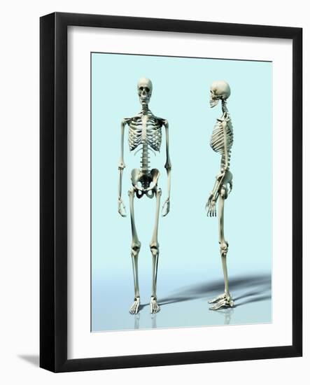 Two Skeletons-Matthias Kulka-Framed Giclee Print