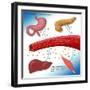 Type II Diabetes-Monica Schroeder-Framed Giclee Print