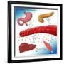 Type II Diabetes-Monica Schroeder-Framed Giclee Print