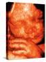 Ultrasound of Foetus' Face-Bernard Benoit-Stretched Canvas