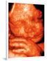 Ultrasound of Foetus' Face-Bernard Benoit-Framed Photographic Print