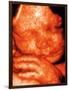 Ultrasound of Foetus' Face-Bernard Benoit-Framed Photographic Print