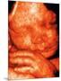 Ultrasound of Foetus' Face-Bernard Benoit-Mounted Photographic Print
