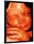 Ultrasound of Foetus' Face-Bernard Benoit-Framed Photographic Print